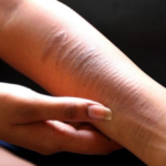 KPAI Mendorong Sanksi Hukum untuk Penyebar Konten Self Harm