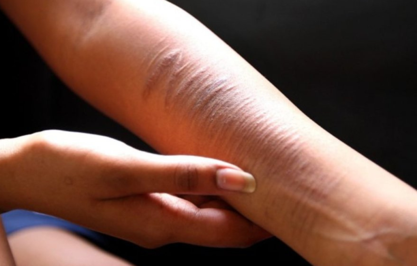 KPAI Mendorong Sanksi Hukum untuk Penyebar Konten Self Harm
