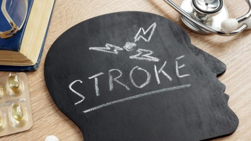 Risiko Stroke Meningkat Akibat Kebiasaan Begadang dan Kurangnya Olahraga