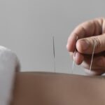 Akupunktur sebagai Alternatif bagi Pasien Stroke