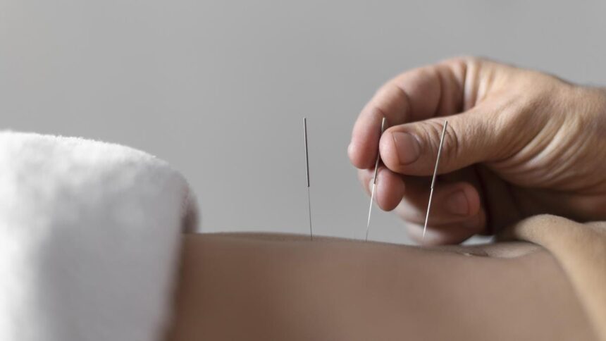 Akupunktur sebagai Alternatif bagi Pasien Stroke