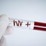PB IDI Menganjurkan Pemerintah Indonesia untuk Menyelenggarakan Hari Tes HIV Nasional