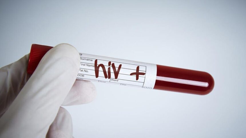 PB IDI Menganjurkan Pemerintah Indonesia untuk Menyelenggarakan Hari Tes HIV Nasional