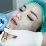 Dermatologi Menyatakan Bahwa Perawatan dengan Masa Pemulihan Singkat Semakin Populer