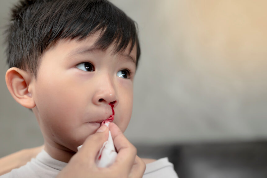 Panduan Penanganan Mimisan pada Anak