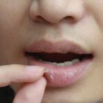 6 Tips Agar Bibir Tetap Lembap Selama Berpuasa