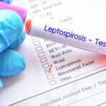 Dapat Menular Melalui Banjir, Apakah Leptospirosis?