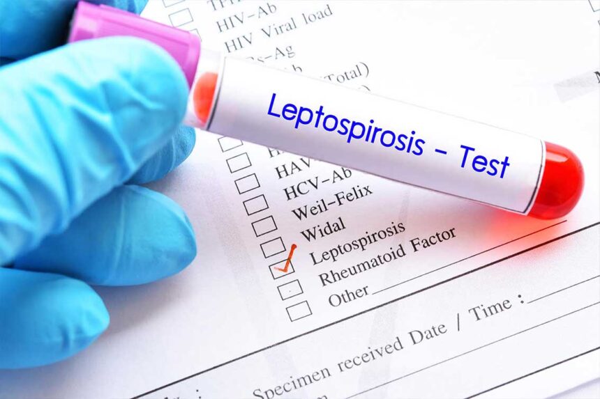 Dapat Menular Melalui Banjir, Apakah Leptospirosis?