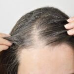 Mengenal Tanda-Tanda Penuaan Rambut, Bukan Hanya Beruban