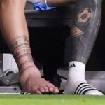 Inter Miami Mengungkap Tingkat Keparahan Cedera Lionel Messi